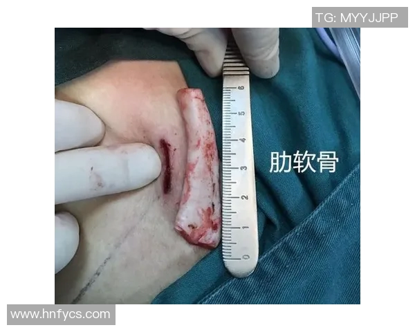 篮球明星为何没有鼻子与肋骨的神秘传说与背后故事解析